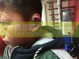 广州特价儿童助听器专卖店常年折扣国际一线大牌5折2000款！